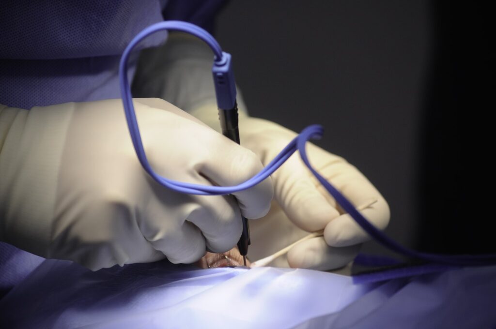 Oculoplastic Surgery Blog Image - Cathedral Eye Clinic